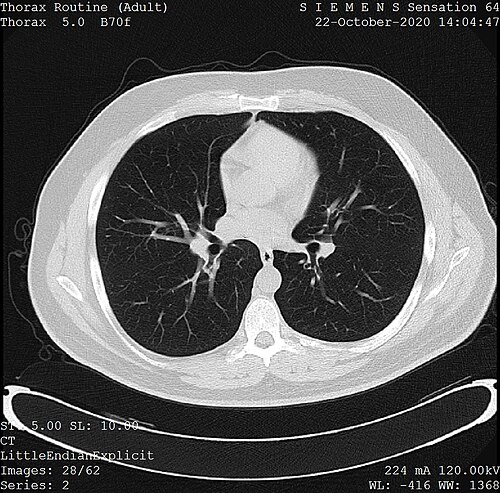 Diagnostic Radiology